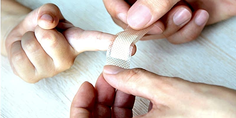 splinter removal